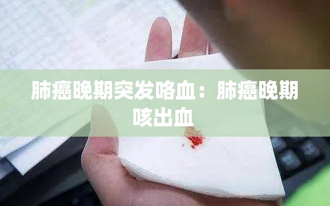 肺癌晚期突发咯血:肺癌晚期咳出血