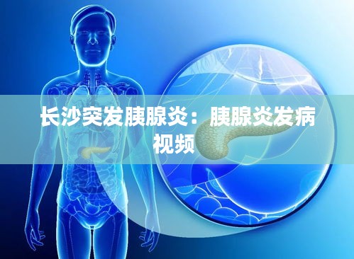 张狂妄行 第4页