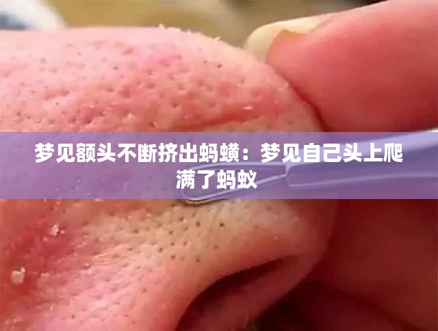 梦见额头不断挤出蚂蟥：梦见自己头上爬满了蚂蚁 