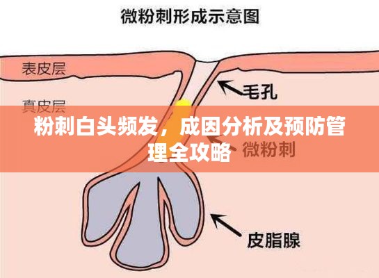 粉刺白头频发，成因分析及预防管理全攻略