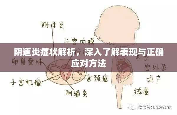 阴道炎症状解析，深入了解表现与正确应对方法