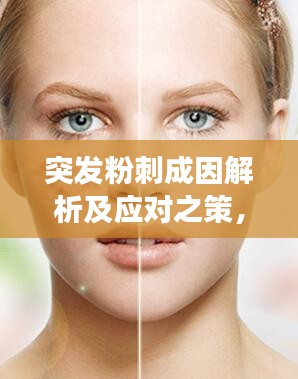 突发粉刺成因解析及应对之策，你的皮肤需要这些护理建议！