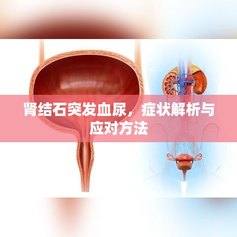 肾结石突发血尿,症状解析与应对方法