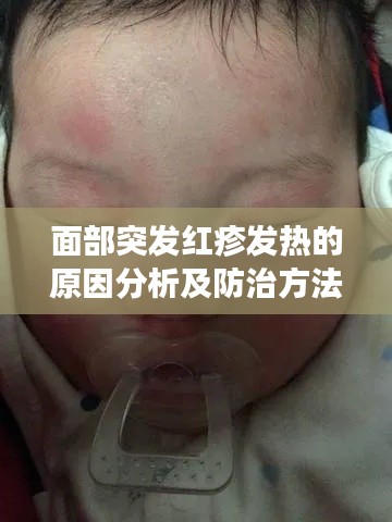 面部突发红疹发热的原因分析及防治方法探讨