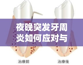 夜晚突发牙周炎如何应对与预防？夜间护牙攻略！