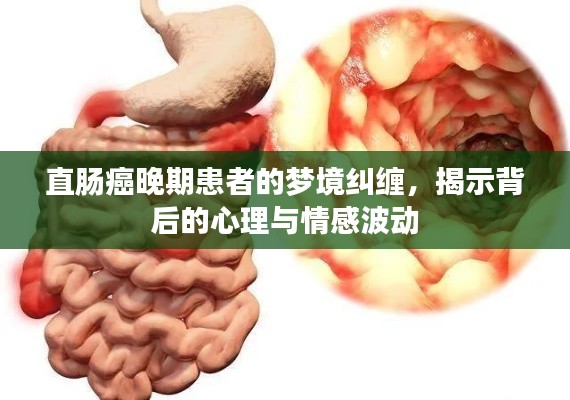直肠癌晚期患者的梦境纠缠，揭示背后的心理与情感波动