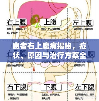 患者右上腹痛揭秘，症状、原因与治疗方案全解析